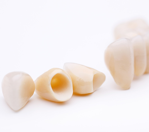 Austin Dental Crowns and Dental Bridges