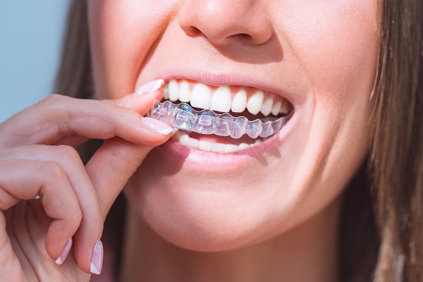 Invisalign Treatment From A General Dentist For Alignment Or Crowding Issues