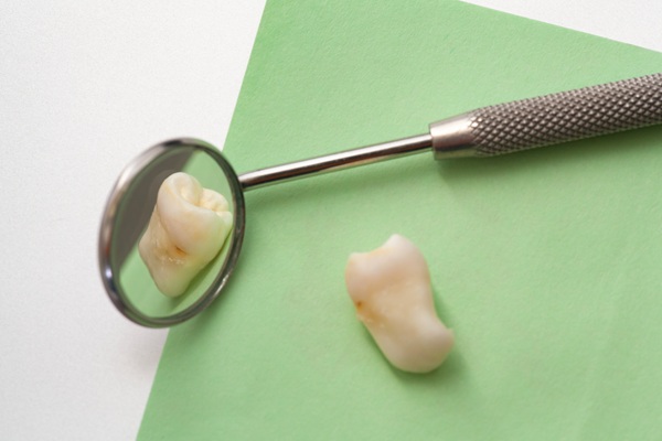 How To Choose Between Tooth Extraction And Root Canal